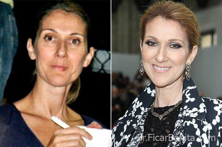 Celine Dion