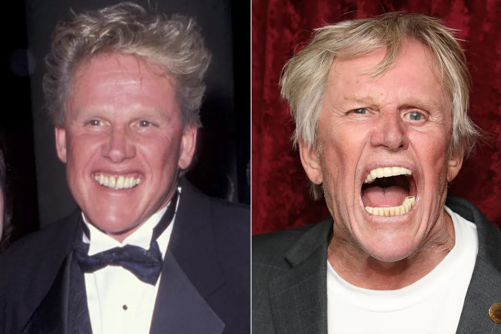 Gary Busey