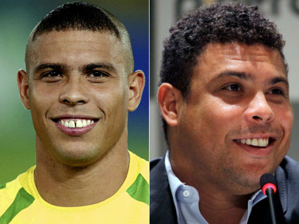 Ronaldo Fenômeno Celebridades que tinham dentes ruins