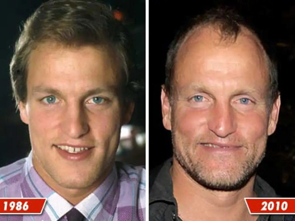 Woody Harrelson