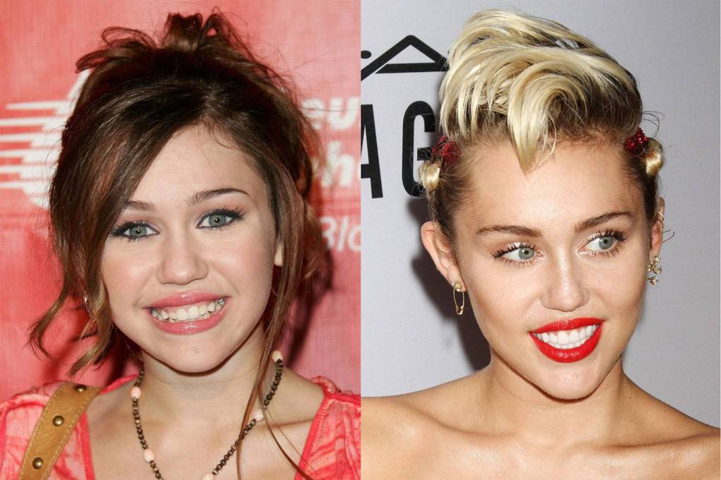 Miley Cyrus As transformações mais dramáticas dos dentes de celebridades