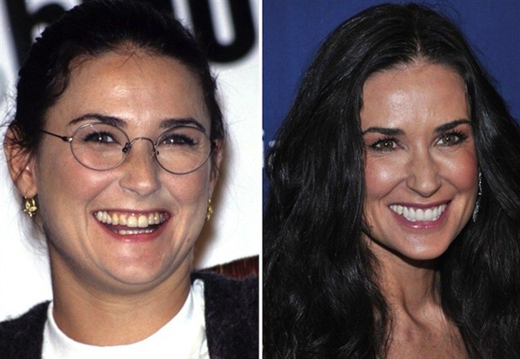 Demi Moore As 20 maiores celebridades com facetas