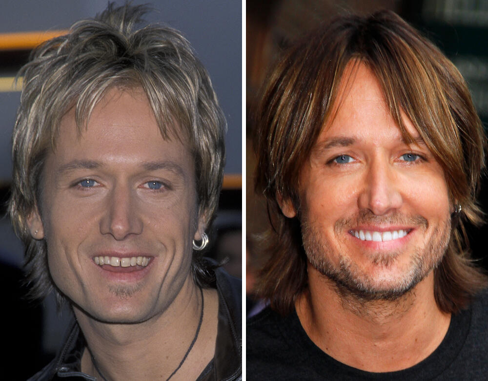 Keith Urban As 20 maiores celebridades com facetas