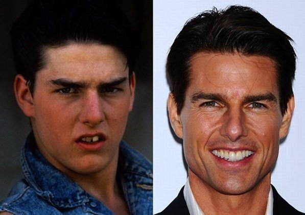Tom Cruise As 20 maiores celebridades com facetas