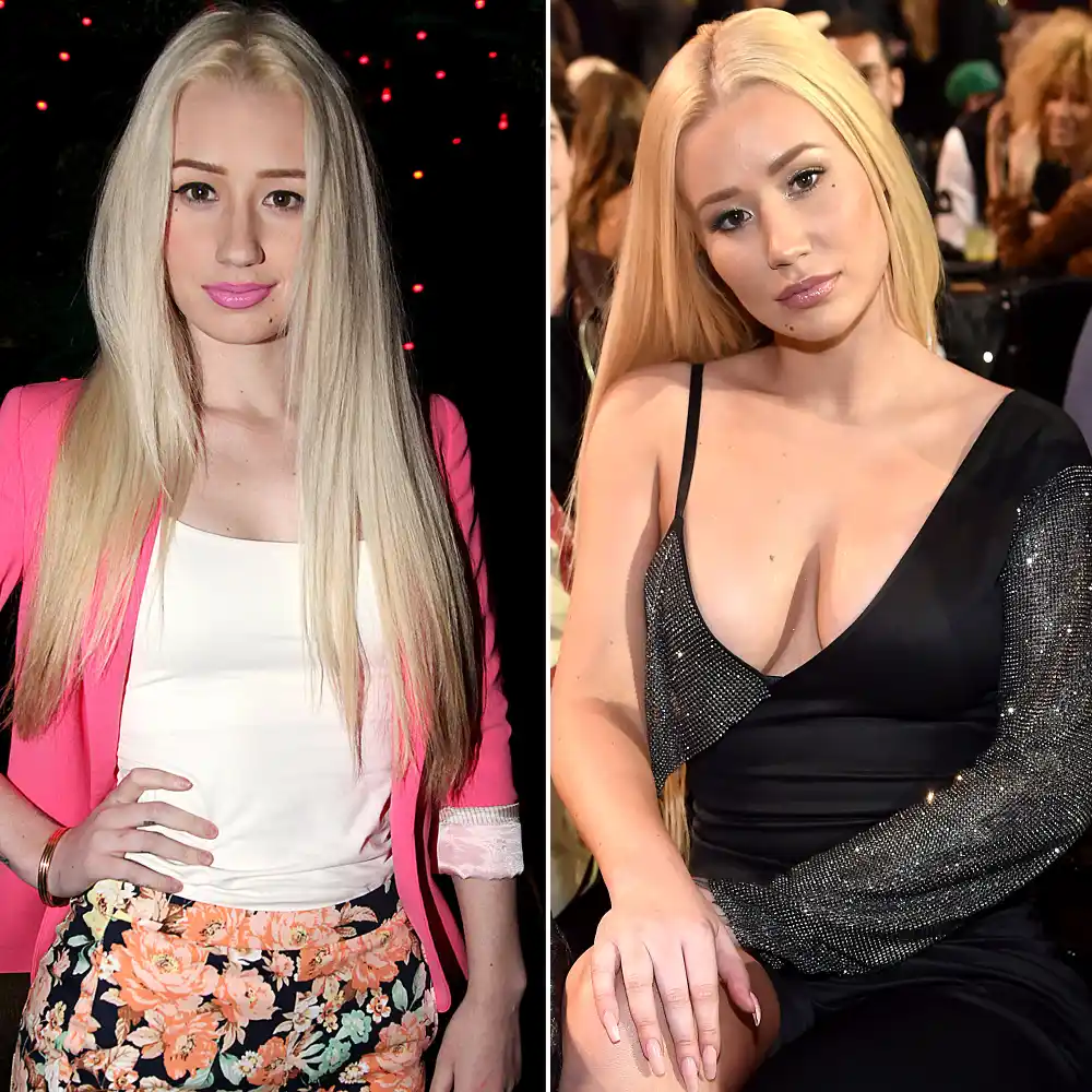 Iggy Azalea