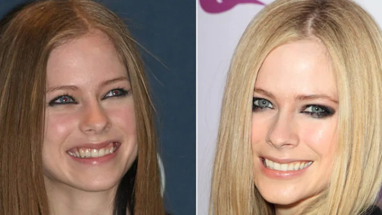 Avril Lavigne - Dentes Desalinhados