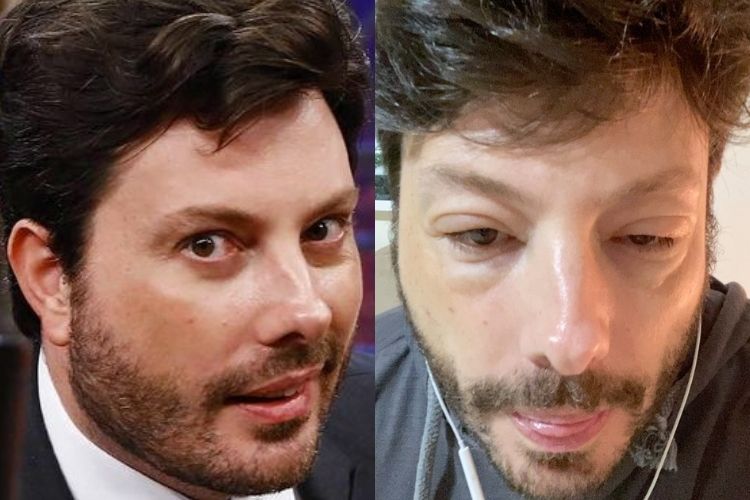 O Antes E Depois Chocante De Celebridades Que Fizeram Cirurgias Pl Sticas P Gina De