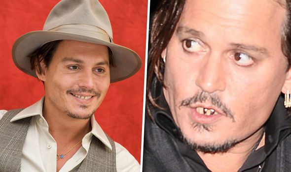 Johnny Depp - Dentes amarelados