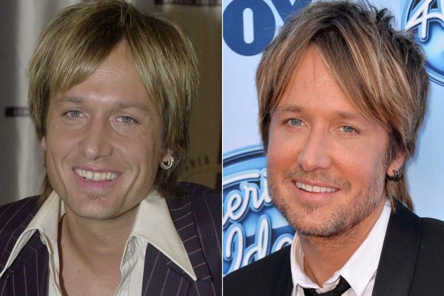 Keith Urban - Dentes Separados