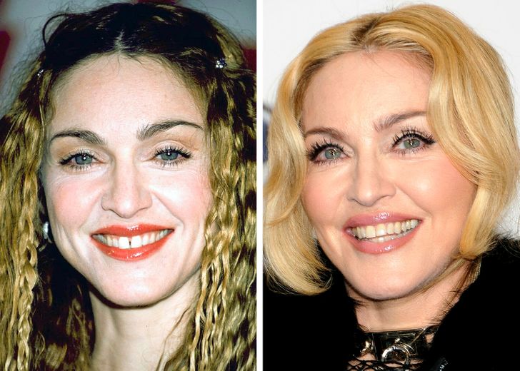 Madonna - Dentes Separados