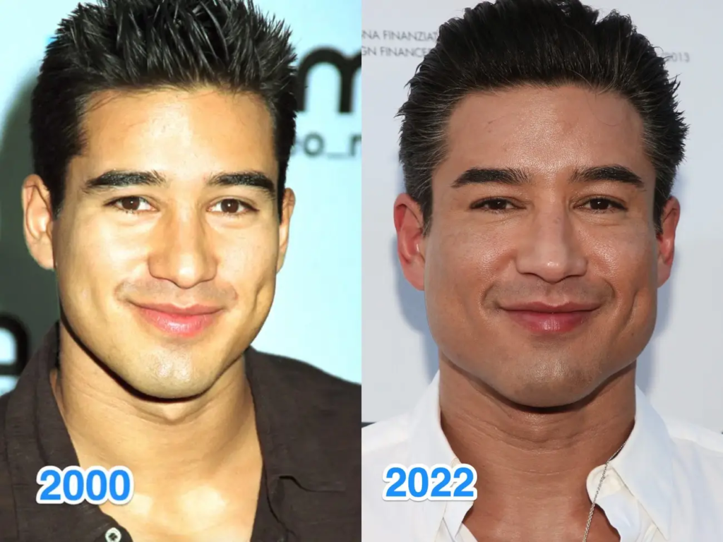 Mario Lopez