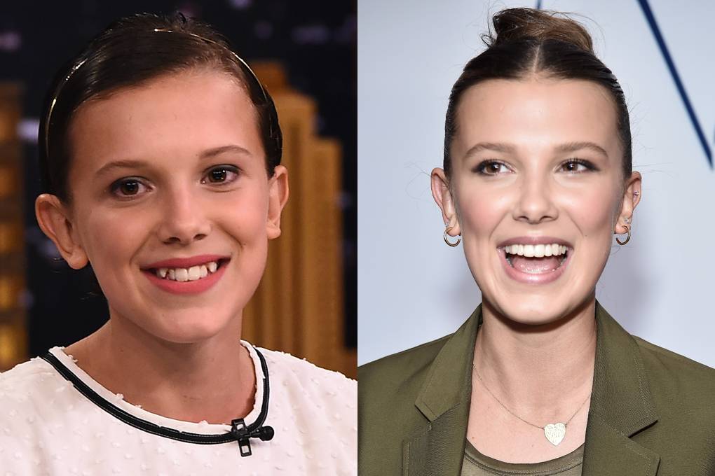 Millie Bobby Brown - Lente de contato dental