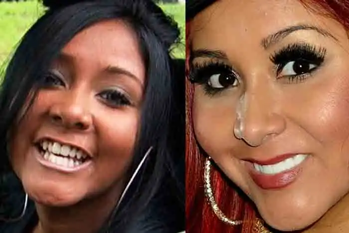 Snooki - Dentes tortos