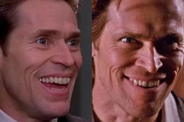 Willem Dafoe - Dentes Separados