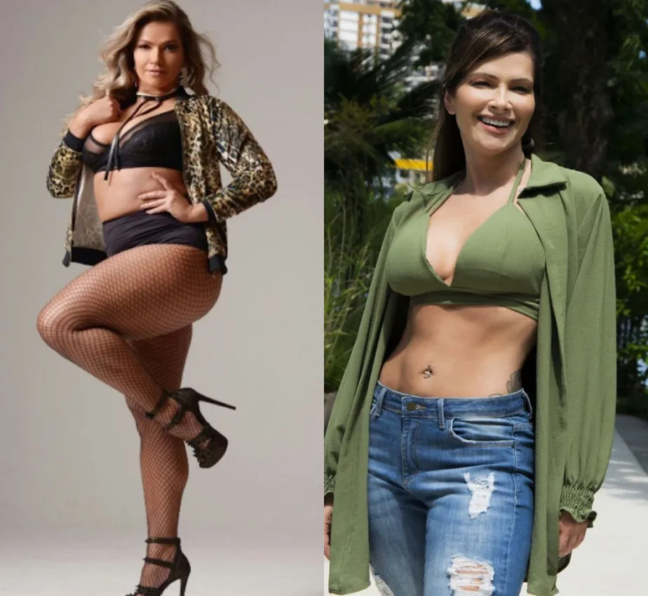 Fani Pacheco e suas mudanças estéticas: Mamoplastia de Aumento e Abdominoplastia