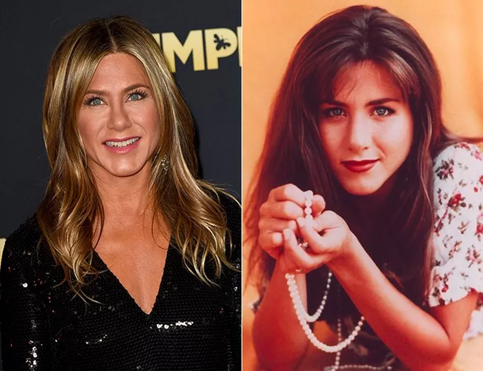 Jennifer Aniston: correção desvio septo nasal, rinoplastia