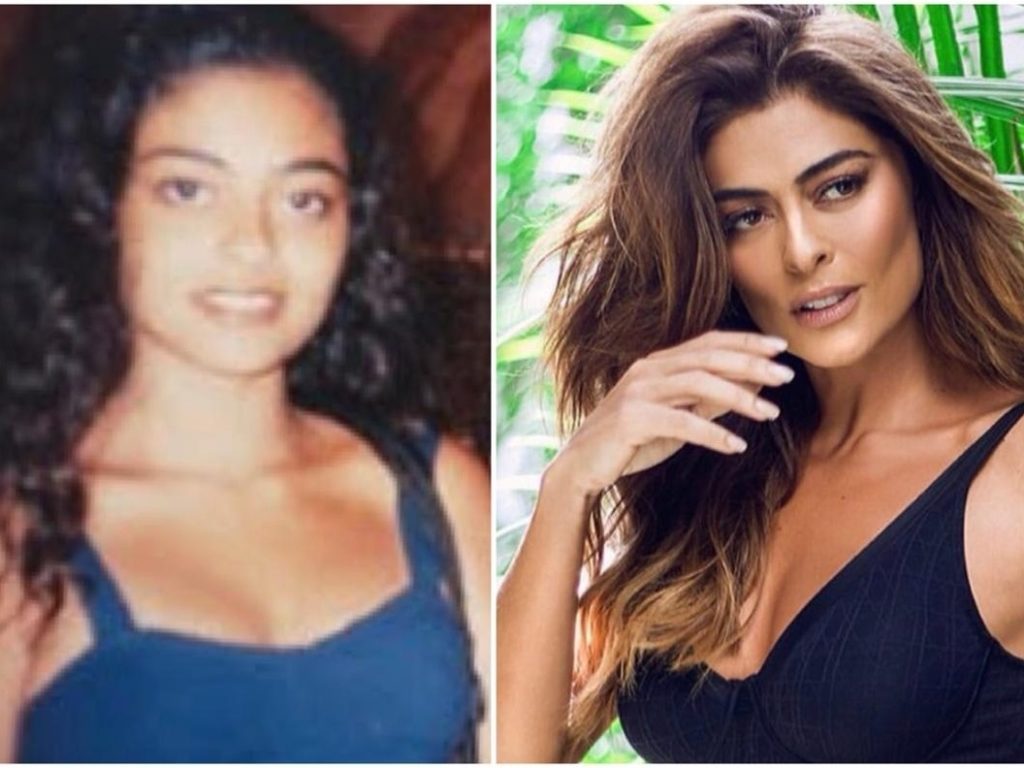 Juliana Paes e sua beleza realçada: Rinoplastia Estética