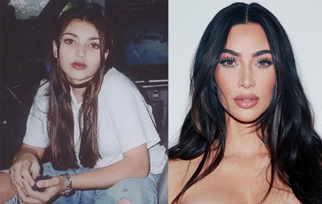 Kim Kardashian: contorno corporal, lipoaspiração, preenchimento glúteos, rinoplastia