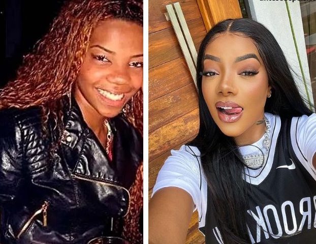 Ludmilla e suas intervenções estéticas: Rinoplastia e Lipoaspiração