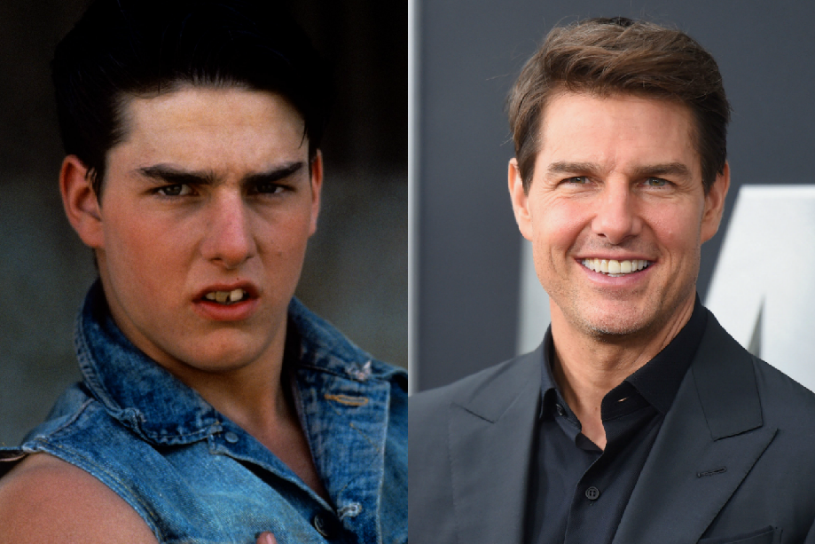 Tom Cruise